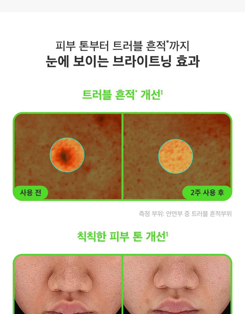 [모공컨트롤샷]폴라초이스 10% 나이아신아마이드 부스터 앰플 20ml 상세페이지 14